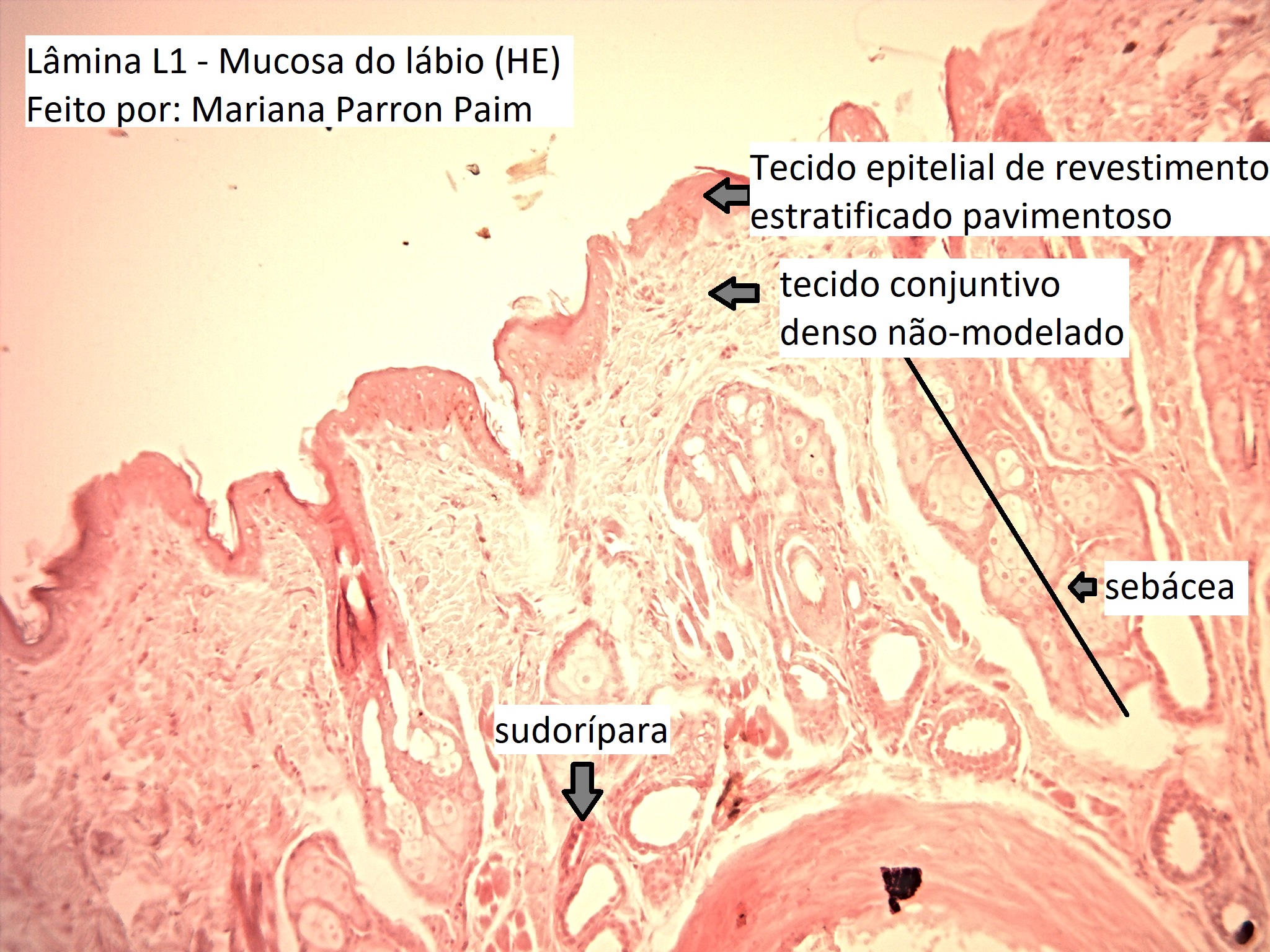 Historep Tecido Conjuntivo