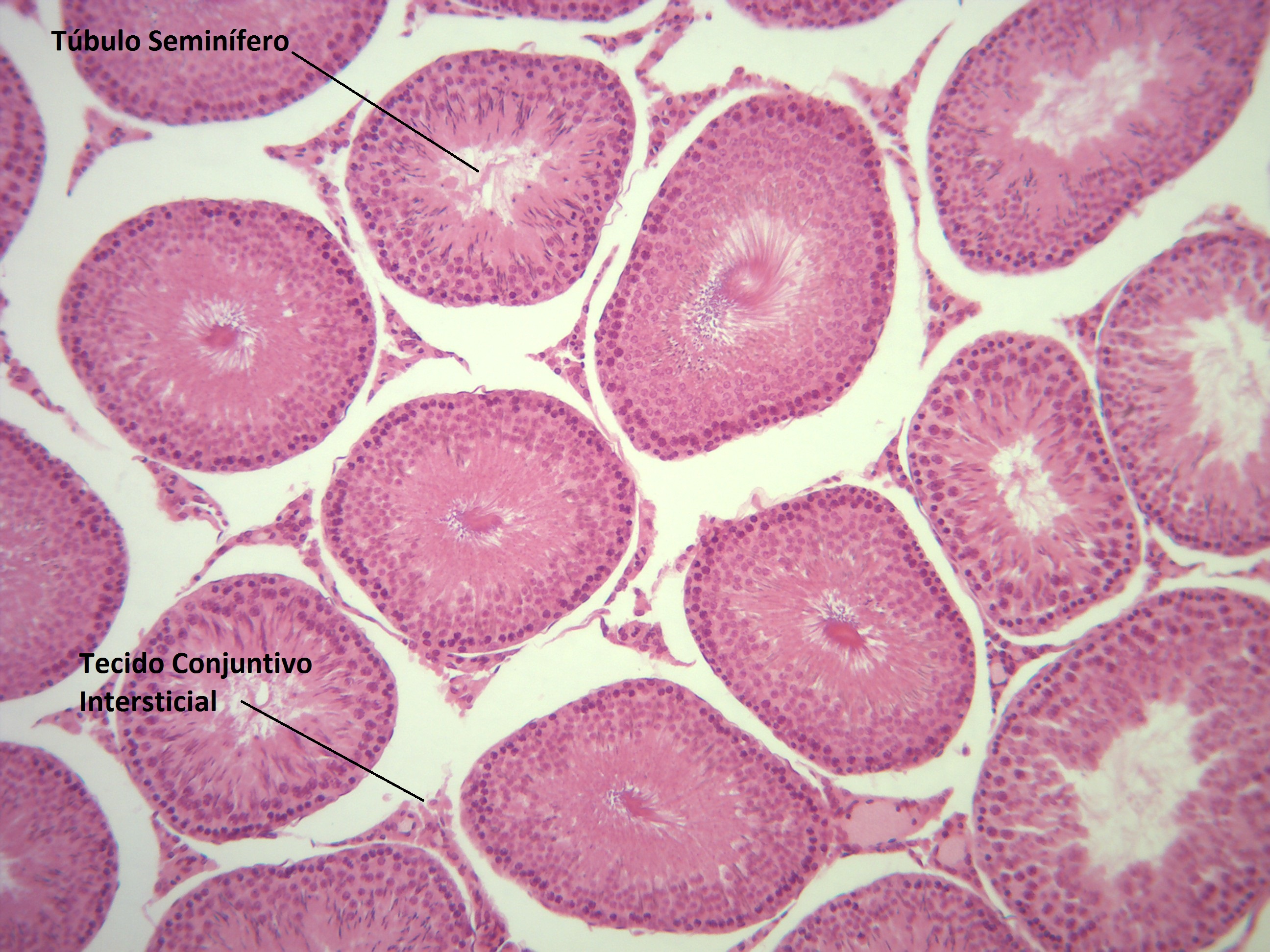 Laminas De Testiculos 5944