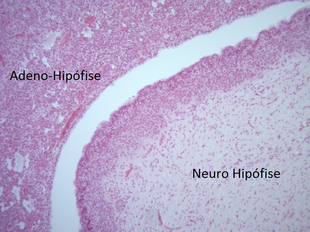 Historep » Adeno e neuro hipofise aumento 2