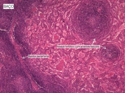 Baço Lâmina i1 Coloração: HE