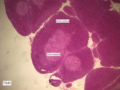 Timo Lâmina: i5 Coloração: HE