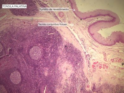 Tonsila Palatina Lâmina: i4 Coloração: HE