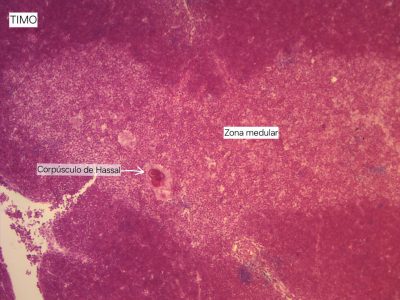 Timo Lâmina: i5 Coloração: HE