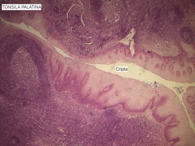 Tonsila Palatina Lâmina: i4 Coloração: HE