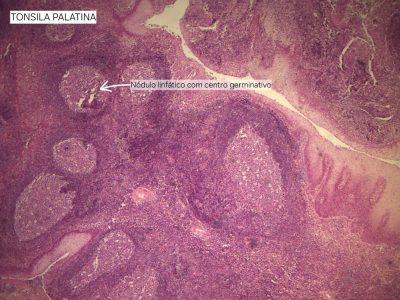 Tonsila Palatina Lâmina: i4 Coloração: HE